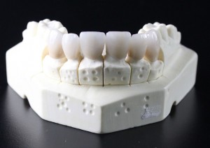 fake tooth