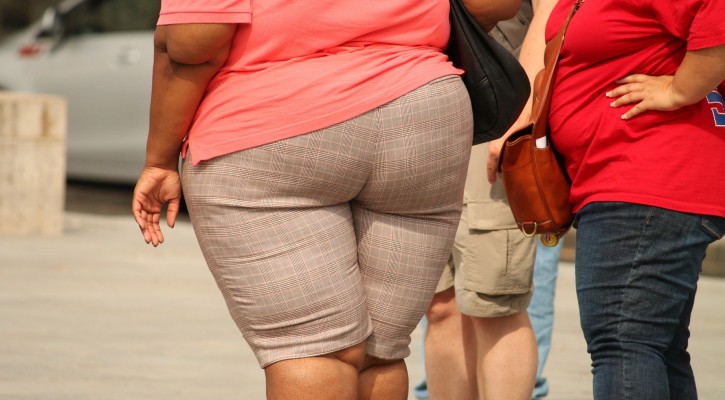 obese woman